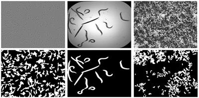 Super resolution-based methodology for self-supervised segmentation of microscopy images
